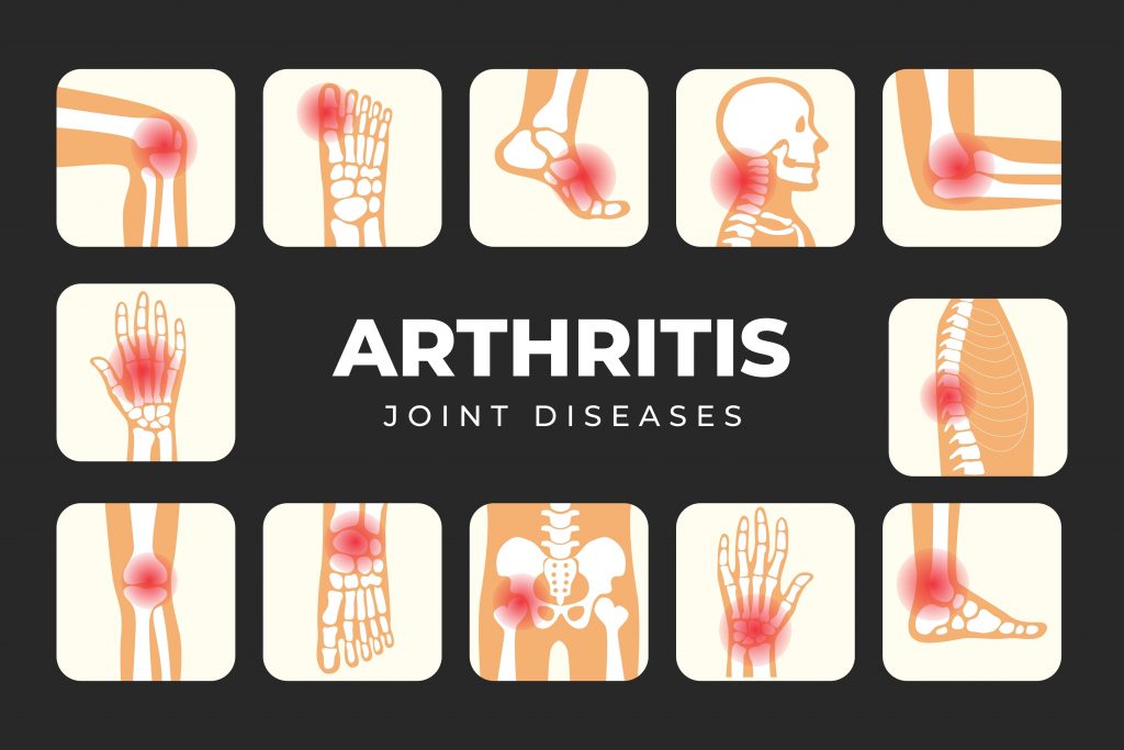 Reumatoidalne zapalenie stawów – jakie testy wykryją problem?